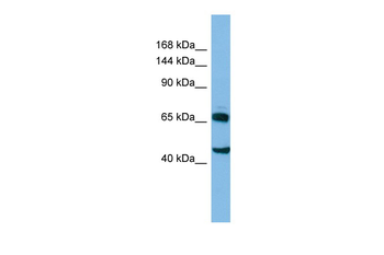 CLASP2 Rabbit Polyclonal Antibody