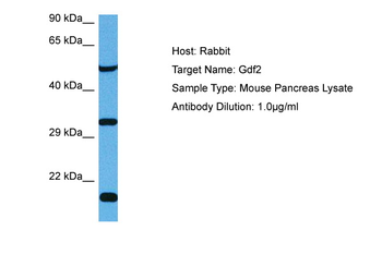 GDF2 Rabbit Polyclonal Antibody