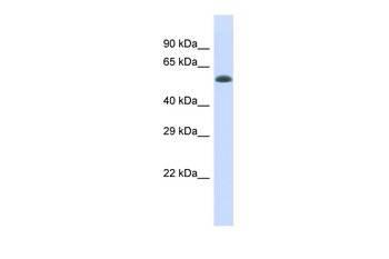 ELP4 Rabbit Polyclonal Antibody