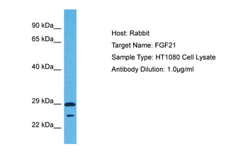 FGF21 Rabbit Polyclonal Antibody