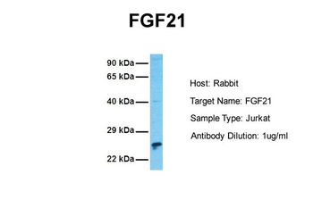 FGF21 Rabbit Polyclonal Antibody
