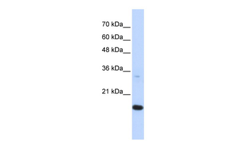 GABARAPL1 Rabbit Polyclonal Antibody