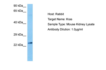 KRAS Rabbit Polyclonal Antibody