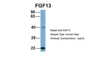 FGF13 Rabbit Polyclonal Antibody