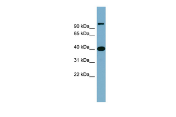 CCNDBP1 Rabbit Polyclonal Antibody