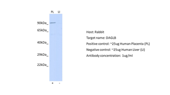 DAGLB Rabbit Polyclonal Antibody