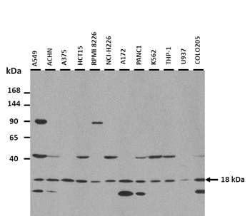 JCHAIN Rabbit Polyclonal Antibody