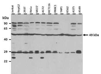 SGMS1 Rabbit Polyclonal Antibody