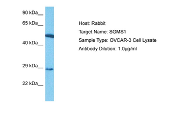 SGMS1 Rabbit Polyclonal Antibody