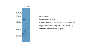 SGMS1 Rabbit Polyclonal Antibody