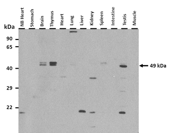 Sgms1 Rabbit Polyclonal Antibody