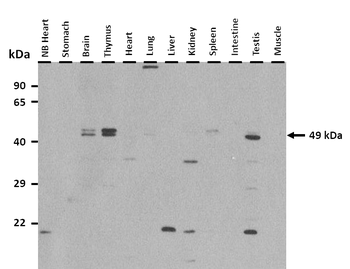 Sgms1 Rabbit Polyclonal Antibody