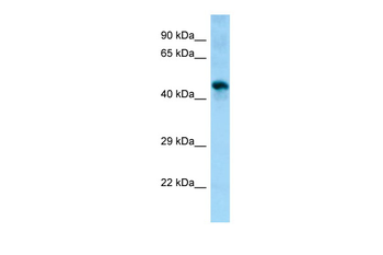 Sgms1 Rabbit Polyclonal Antibody