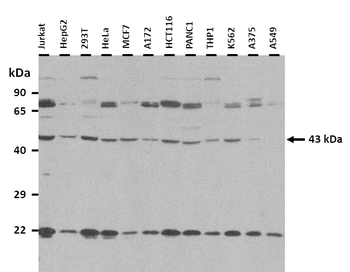 USP12 Rabbit Polyclonal Antibody