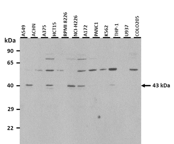 SS18L1 Rabbit Polyclonal Antibody