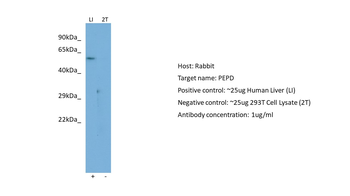 PEPD Rabbit Polyclonal Antibody