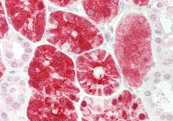 PEPD Rabbit Polyclonal Antibody