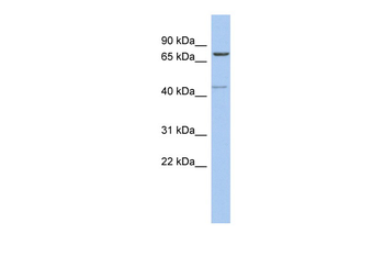 PEX5 Rabbit Polyclonal Antibody