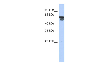 BLMH Rabbit Polyclonal Antibody
