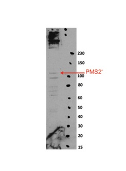 PMS2 Rabbit Polyclonal Antibody