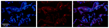 BCKDHA Rabbit Polyclonal Antibody