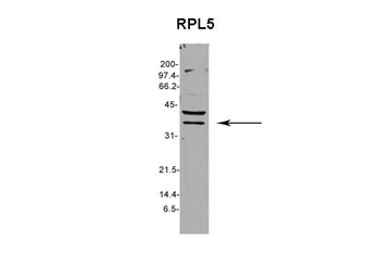 RPL5 Rabbit Polyclonal Antibody