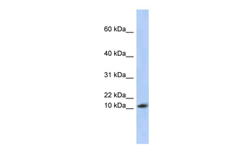 RPL30 Rabbit Polyclonal Antibody
