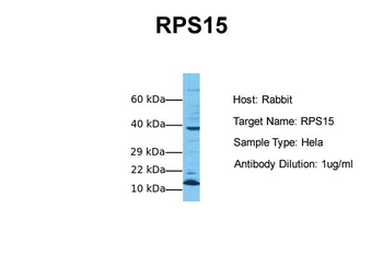RPS15 Rabbit Polyclonal Antibody