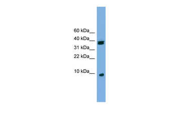 RPS21 Rabbit Polyclonal Antibody