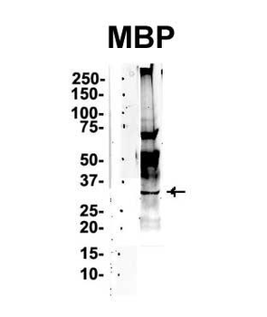 MBP Rabbit Polyclonal Antibody
