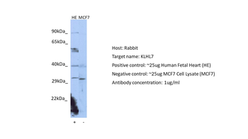 KLHL7 Rabbit Polyclonal Antibody