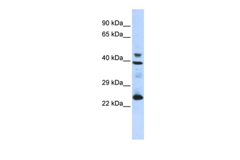 SELENOP Rabbit Polyclonal Antibody