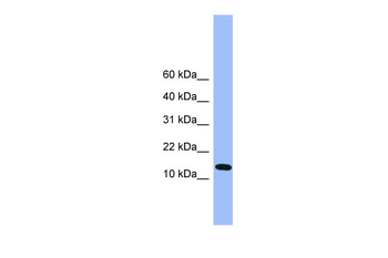 Atp5d Rabbit Polyclonal Antibody