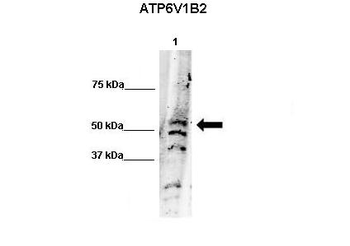 ATP6V1B2 Rabbit Polyclonal Antibody