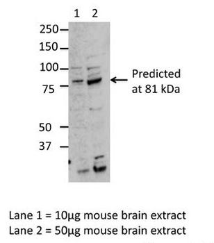 MARK3 Rabbit Polyclonal Antibody