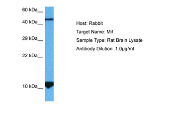 MIF Rabbit Polyclonal Antibody