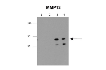 MMP13 Rabbit Polyclonal Antibody