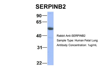 SERPINB2 Rabbit Polyclonal Antibody