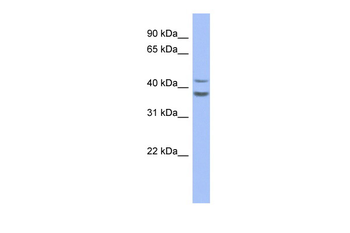 SERPINB2 Rabbit Polyclonal Antibody