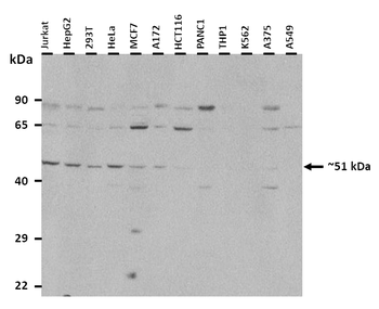 CFP Rabbit Polyclonal Antibody