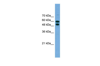 PGM1 Rabbit Polyclonal Antibody