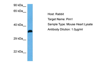 PIM1 Rabbit Polyclonal Antibody