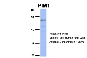 PIM1 Rabbit Polyclonal Antibody
