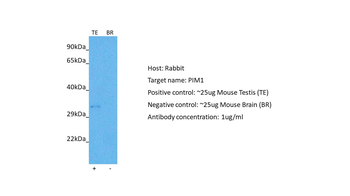 PIM1 Rabbit Polyclonal Antibody
