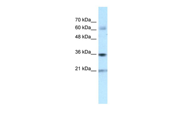 PIM1 Rabbit Polyclonal Antibody