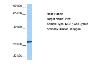 PIM1 Rabbit Polyclonal Antibody