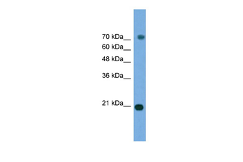 MAPK6 Rabbit Polyclonal Antibody