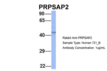 PRPSAP2 Rabbit Polyclonal Antibody