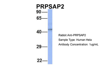 PRPSAP2 Rabbit Polyclonal Antibody