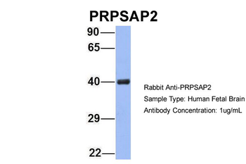 PRPSAP2 Rabbit Polyclonal Antibody